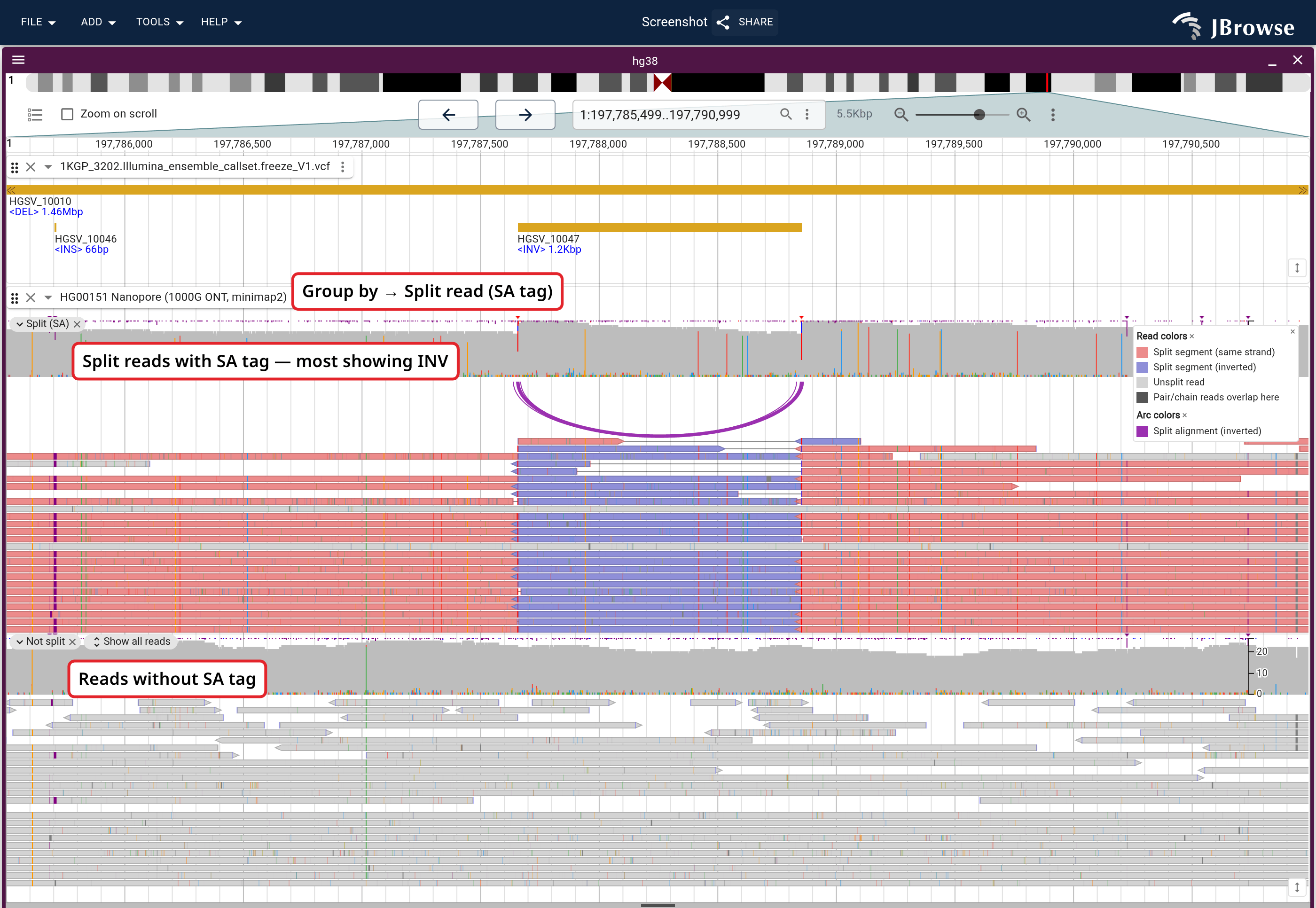 Reads grouped by Group by... → Split read (SA tag) over HGSV_10047 in HG00151 nanopore reads, with the 1KGP ensemble VCF call above. The split reads in the upper section break into three pieces with the middle one reversed; the reads below cross the same span in one piece.