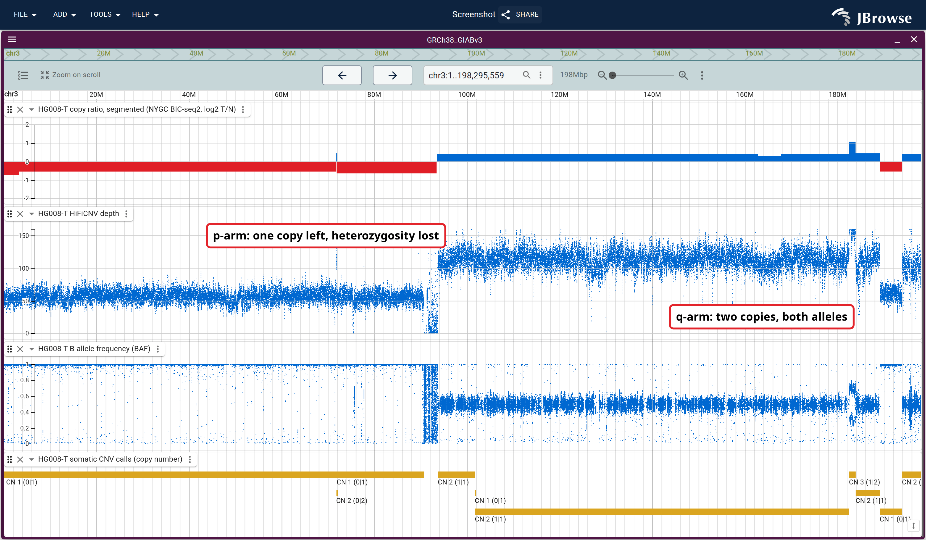 Chromosome 3 over the benchmark CNV calls: BIC-seq2's segmented log2 copy ratio, the HiFiCNV depth it summarizes, and B-allele frequency. The p-arm is a single-copy loss with loss-of-heterozygosity; the q-arm is balanced.