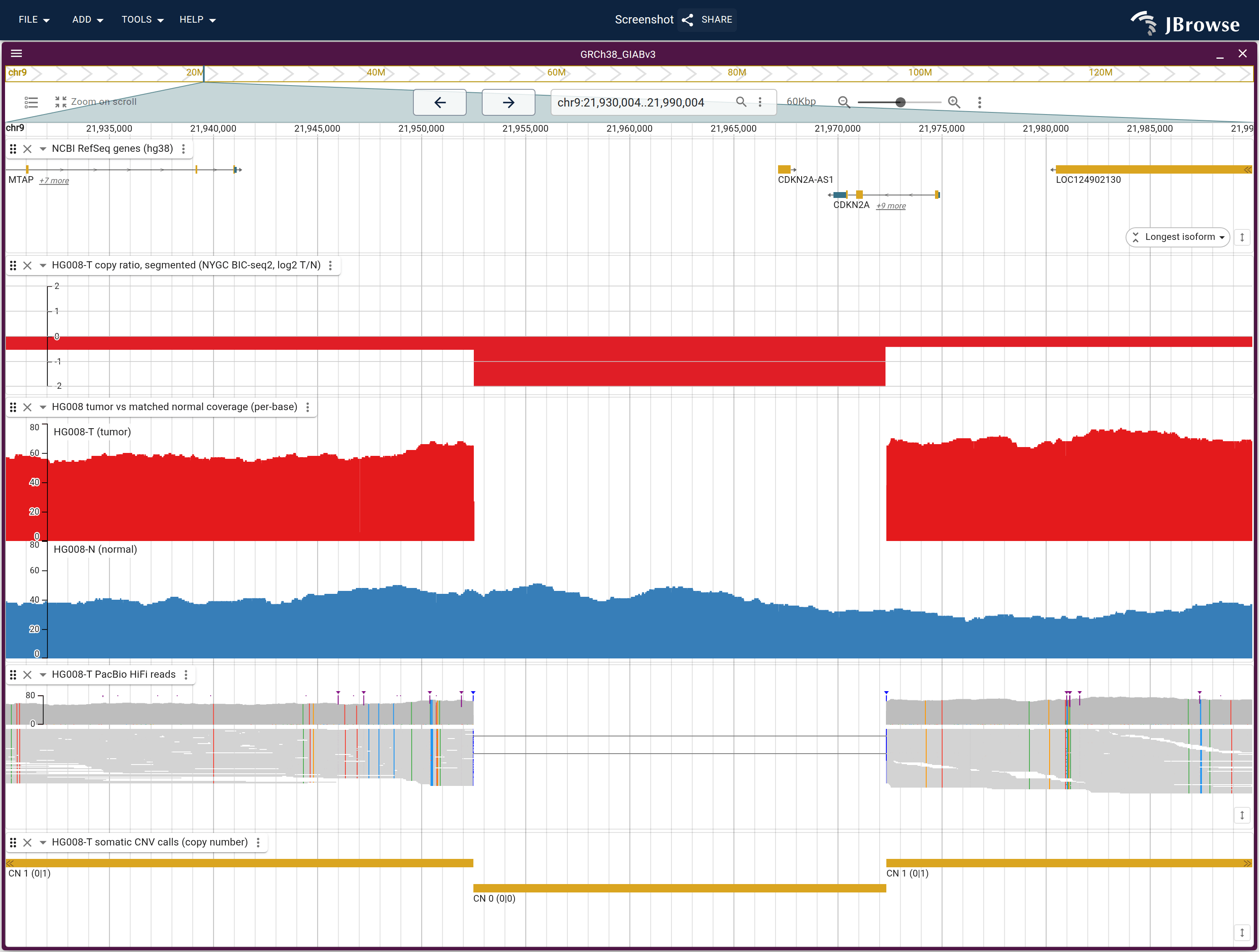The CDKN2A deletion at 60 kb: coverage drops out in the tumor row and not in the normal, the read pileup drops out with it, and the CNV call under them reads CN 0.